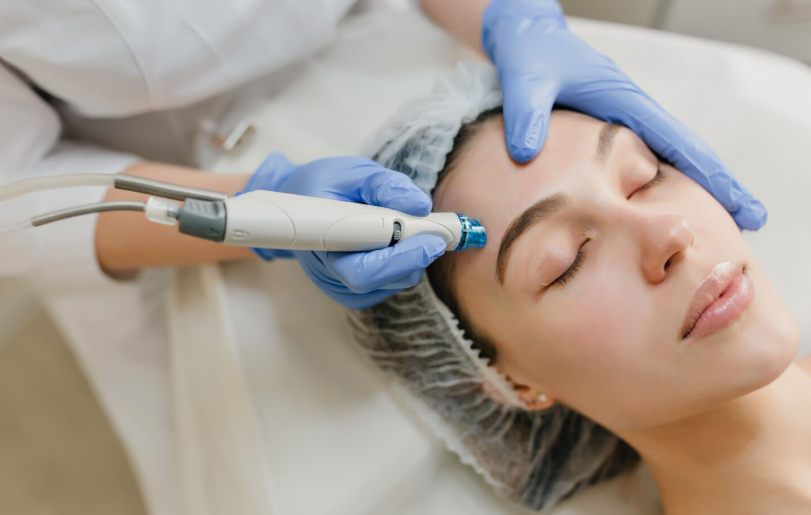 Microneedling