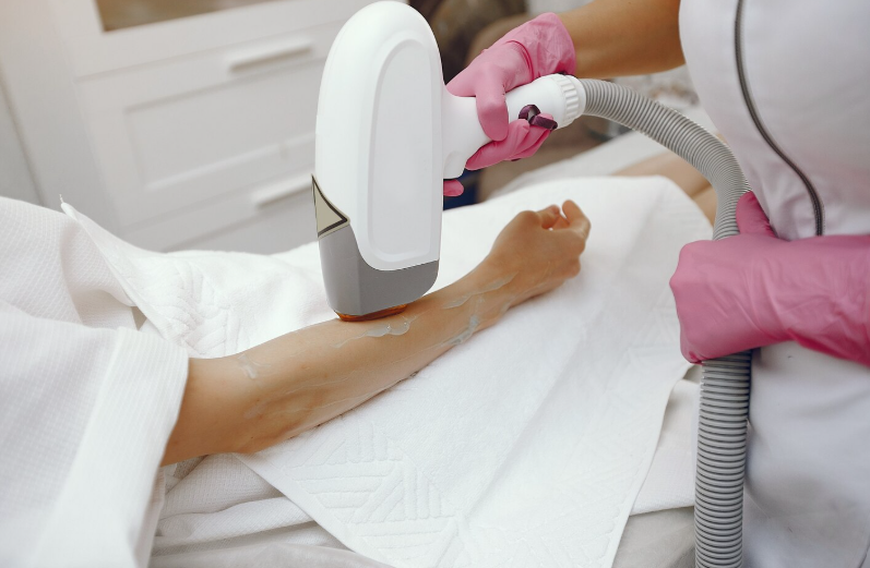 Laser Hair Removal Areas